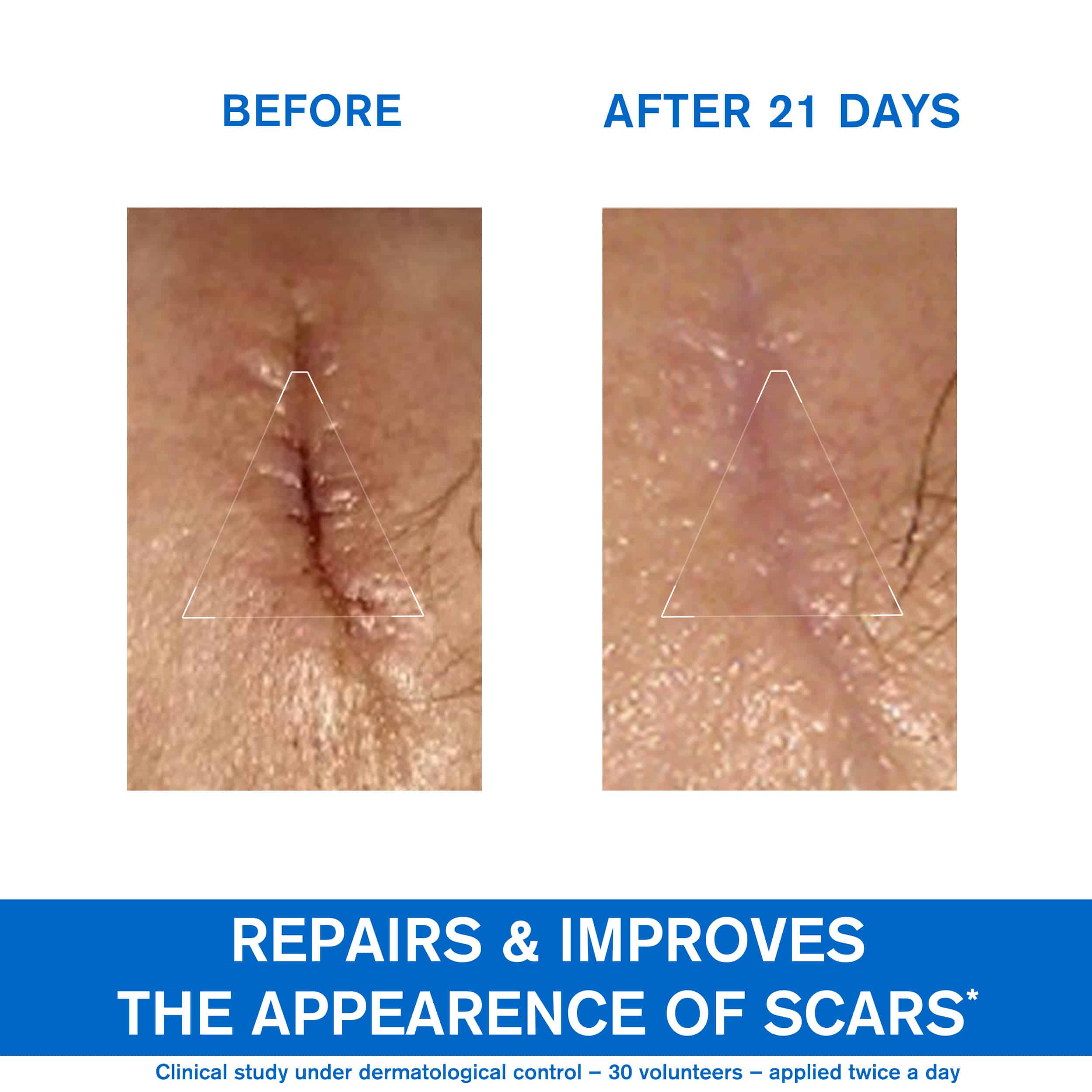 URIAGE - BARIEDERM Cica Cream Reparatrice au Cu-Zn - 100ml
