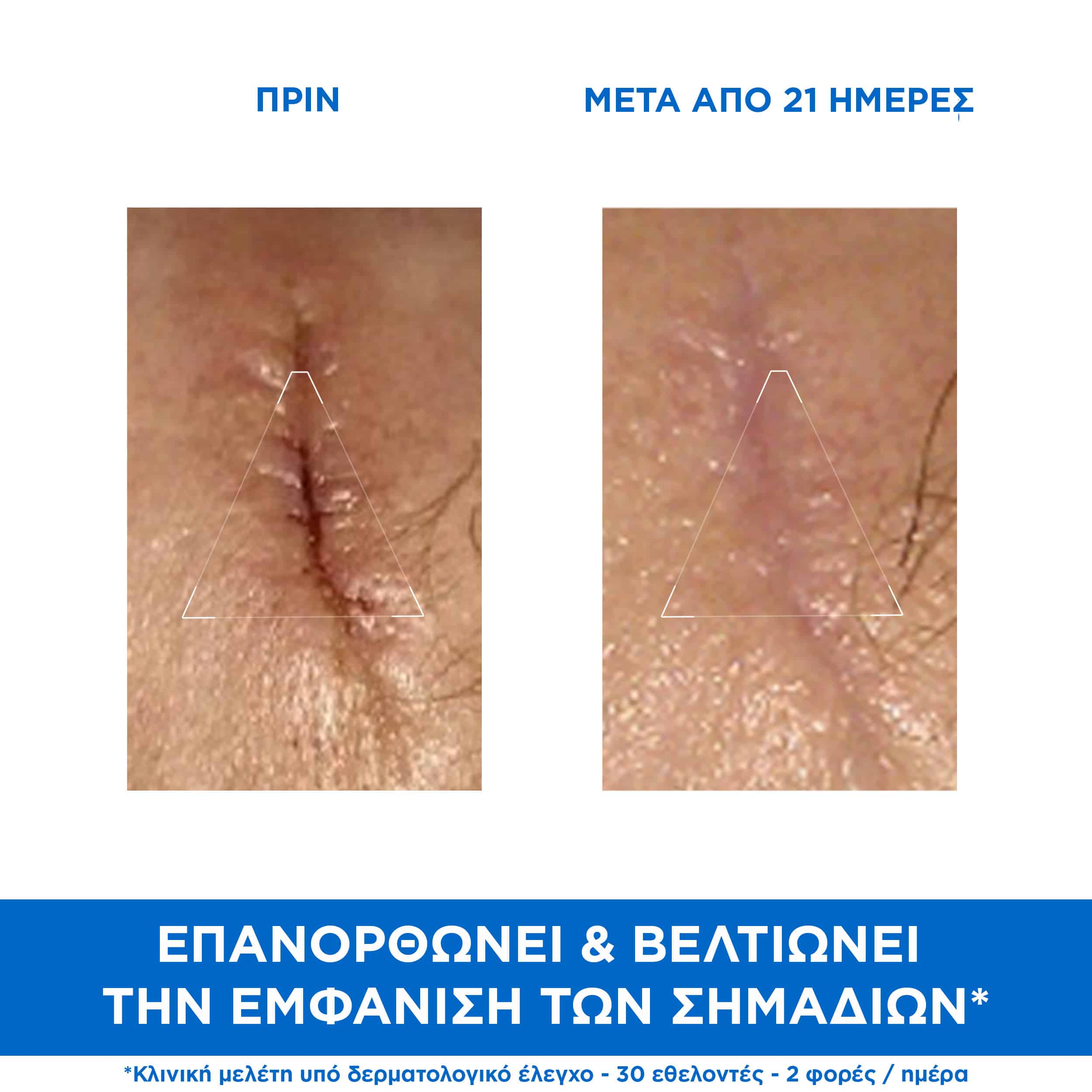 URIAGE - BARIEDERM Cica Cream Reparatrice au Cu-Zn - 40ml