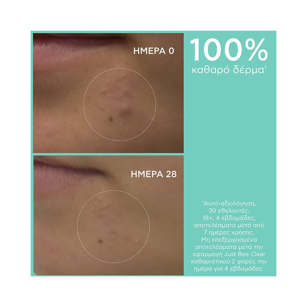 APIVITA - JUST BEE CLEAR Gel Καθαρισμού με propolis AmC & φυτικό σαλικυλικό οξύ - 200ml