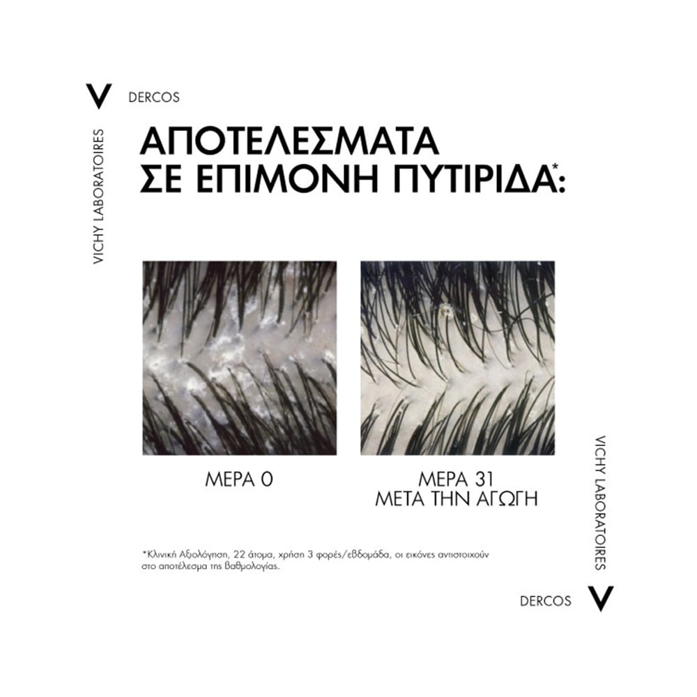 VICHY - DERCOS Shampooing Anti-Dandruff DS (refill) - 390ml Dry Hair