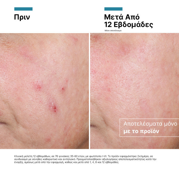 SKINCEUTICALS - CORRECT Advanced RGN-6 - 50ml