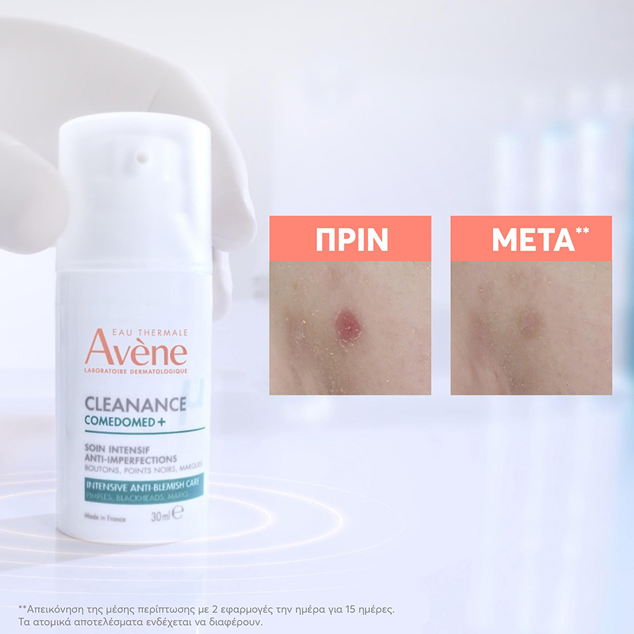 AVENE - CLEANANCE COMEDOMED+ Κρέμα-Gel κατά των Ατελειών με Comedoclastin για Δέρμα με Τάση Ακμής - 30ml