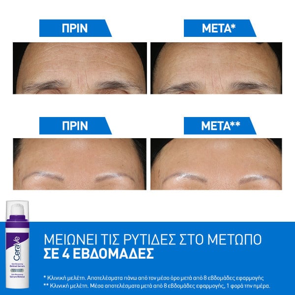 CERAVE - Skin Renewing Retinol Serum - 30ml