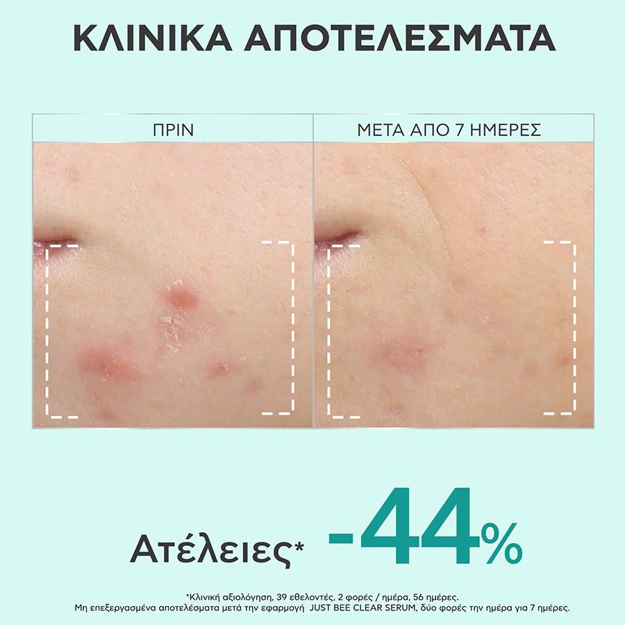 APIVITA - JUST BEE CLEAR Ορός Λείανσης - 30ml