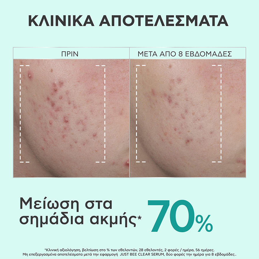 APIVITA - JUST BEE CLEAR Ορός Λείανσης - 30ml