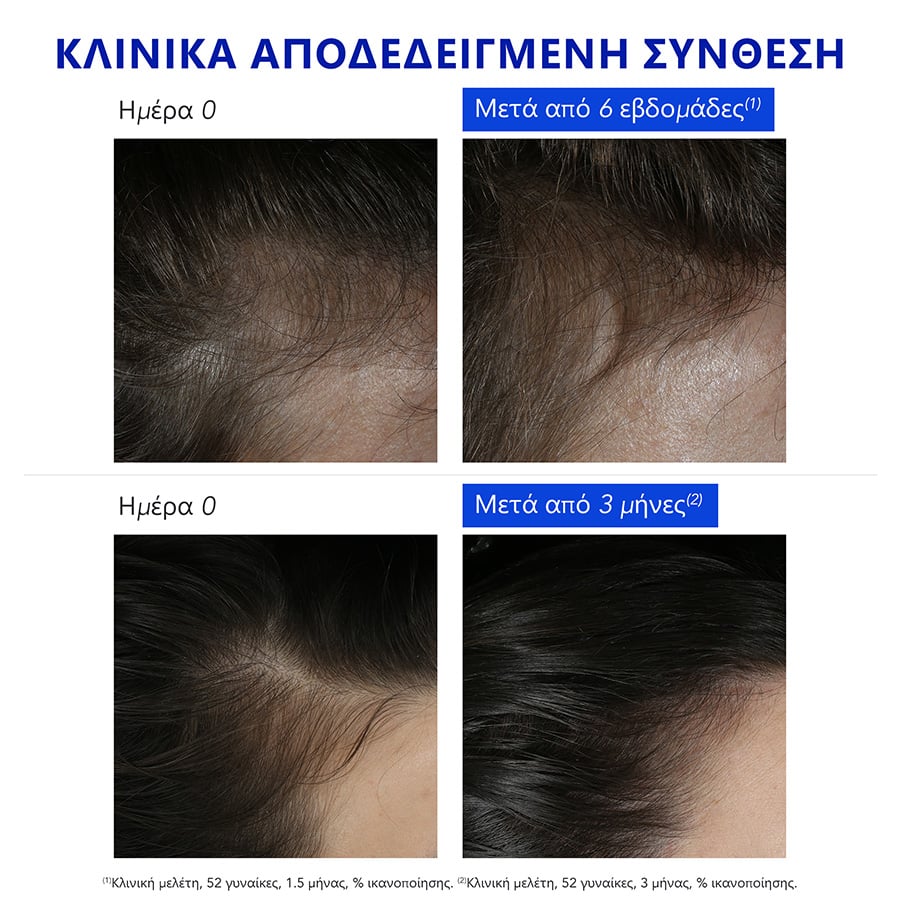 PHYTO - PHYTOPHANERE Anti-Reactive Hair Loss Αντιδραστική Θεραπεία κατά της Τριχόπτωσης - 12vialsx5ml