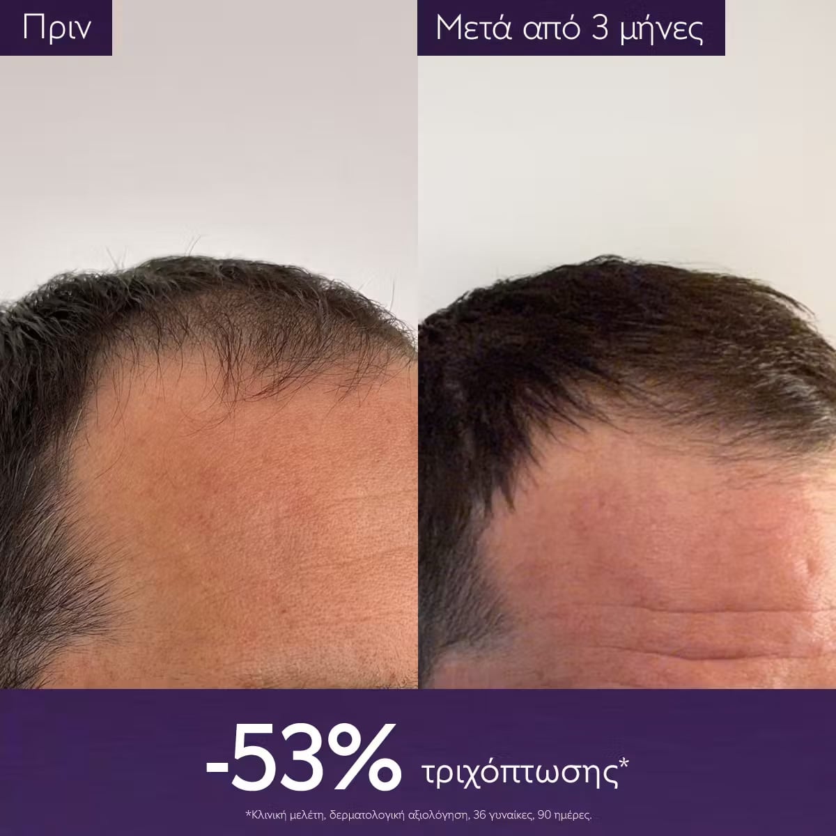 CAUDALIE - Anti-Hair Loss Serum Ορός μαλλιών κατά της τριχόπτωσης - 50ml
