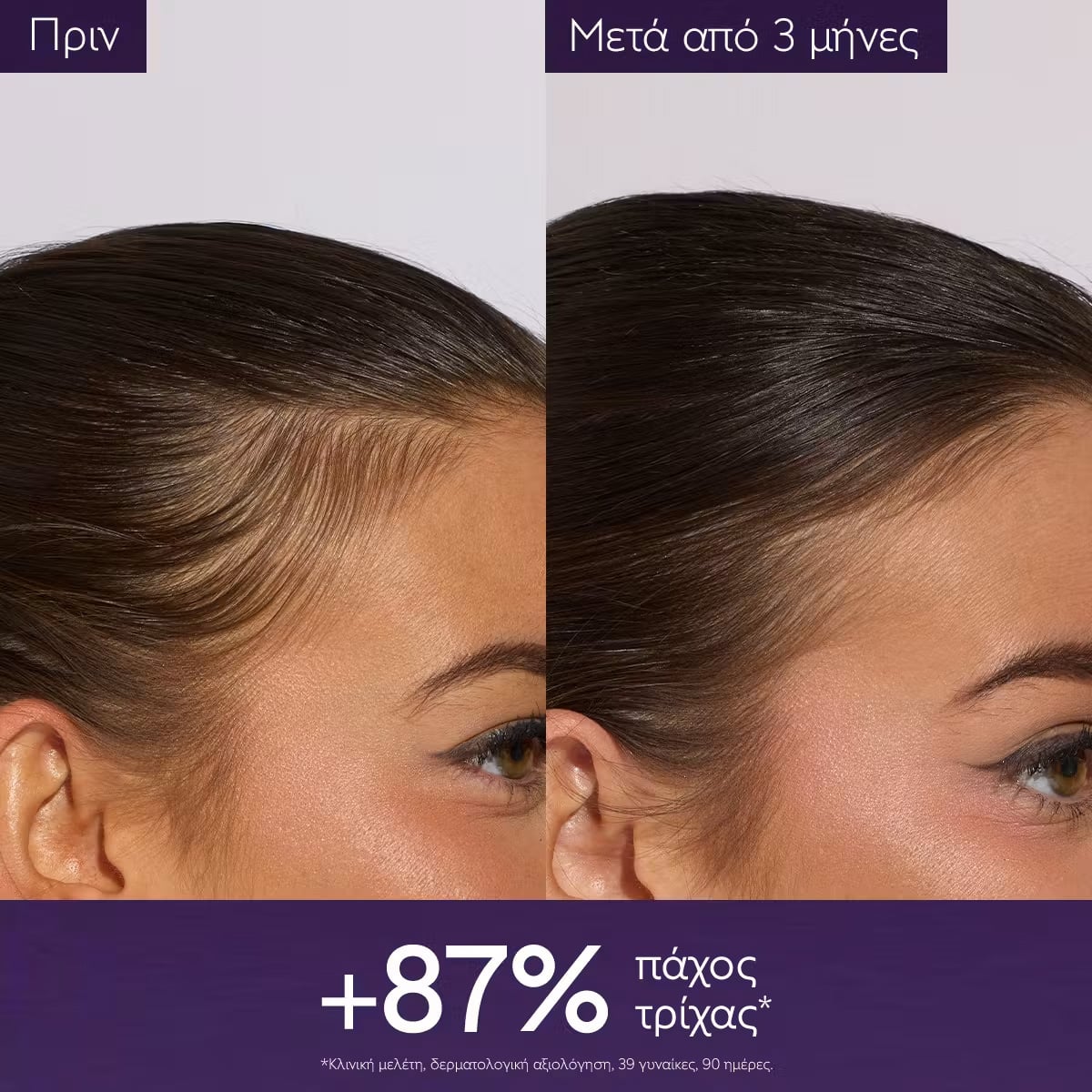 CAUDALIE - Anti-Hair Loss Serum Ορός μαλλιών κατά της τριχόπτωσης - 50ml