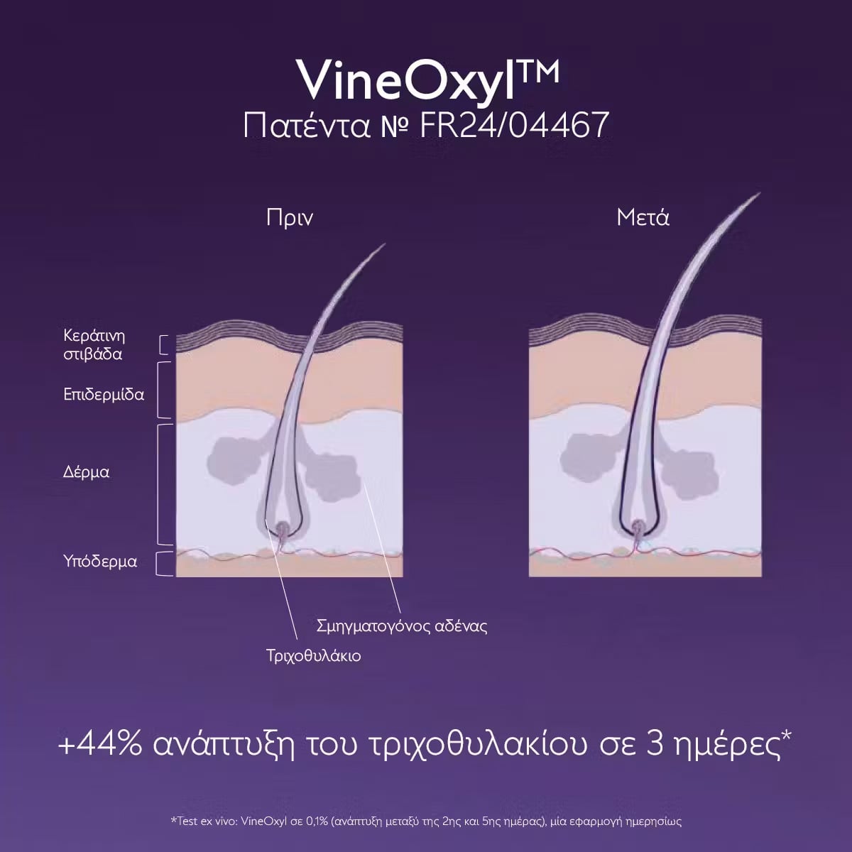 CAUDALIE - Anti-Hair Loss Serum Ορός μαλλιών κατά της τριχόπτωσης - 50ml
