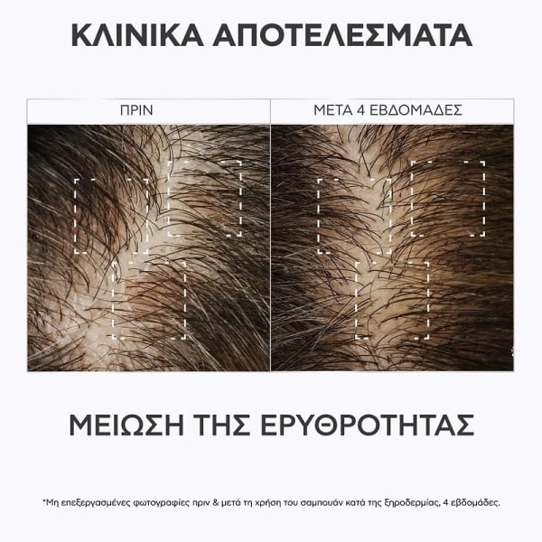 APIVITA - Δερματολογικό Σαμπουάν κατά της Ξηροδερμίας με propolis AC & φυτικό AHA - 250ml