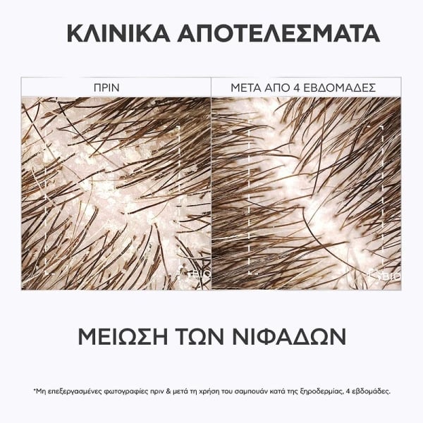 APIVITA - Δερματολογικό Σαμπουάν κατά της Ξηροδερμίας με propolis AC & φυτικό AHA - 250ml