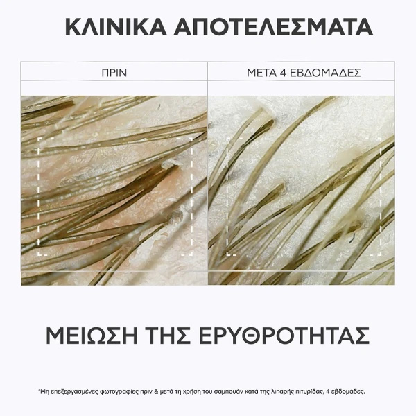 APIVITA - Δερματολογικό Σαμπουάν κατά της Λιπαρής Πιτυρίδας με propolis AmC & φυτικό AHA - 250ml