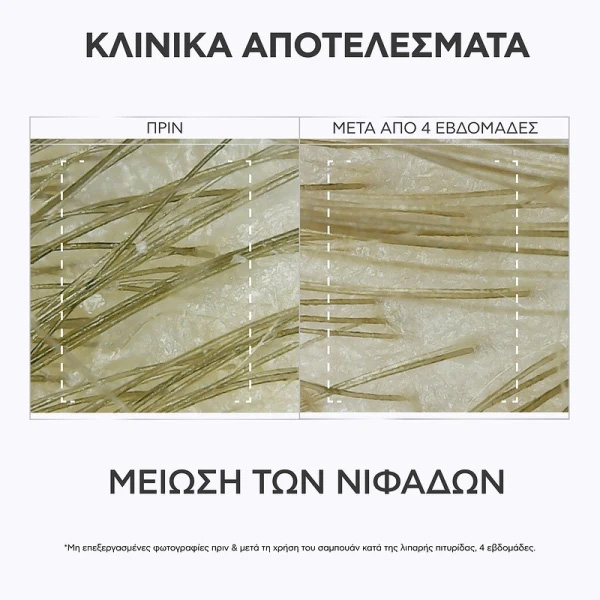 APIVITA - Δερματολογικό Σαμπουάν κατά της Λιπαρής Πιτυρίδας με propolis AmC & φυτικό AHA - 250ml