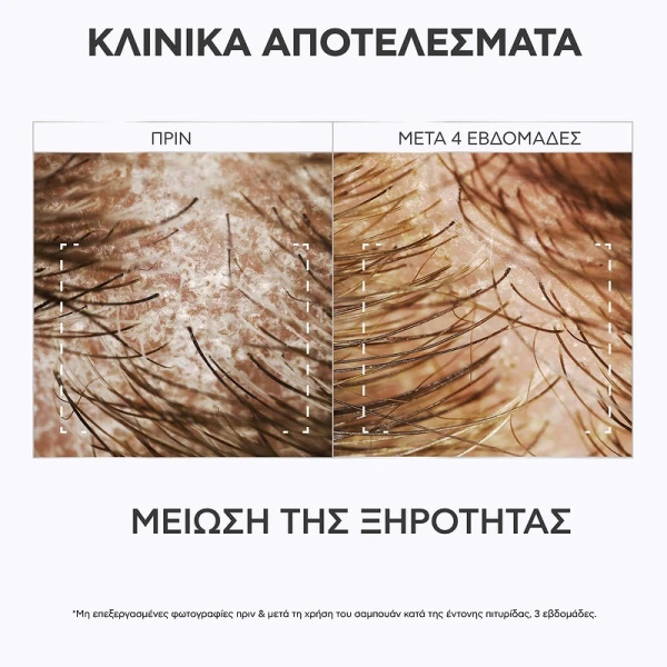 APIVITA - Δερματολογική Λοσιόν Άμεσης Ανακούφισης του Τριχωτού με propolis AmC & Φυτικό AHA - 100ml
