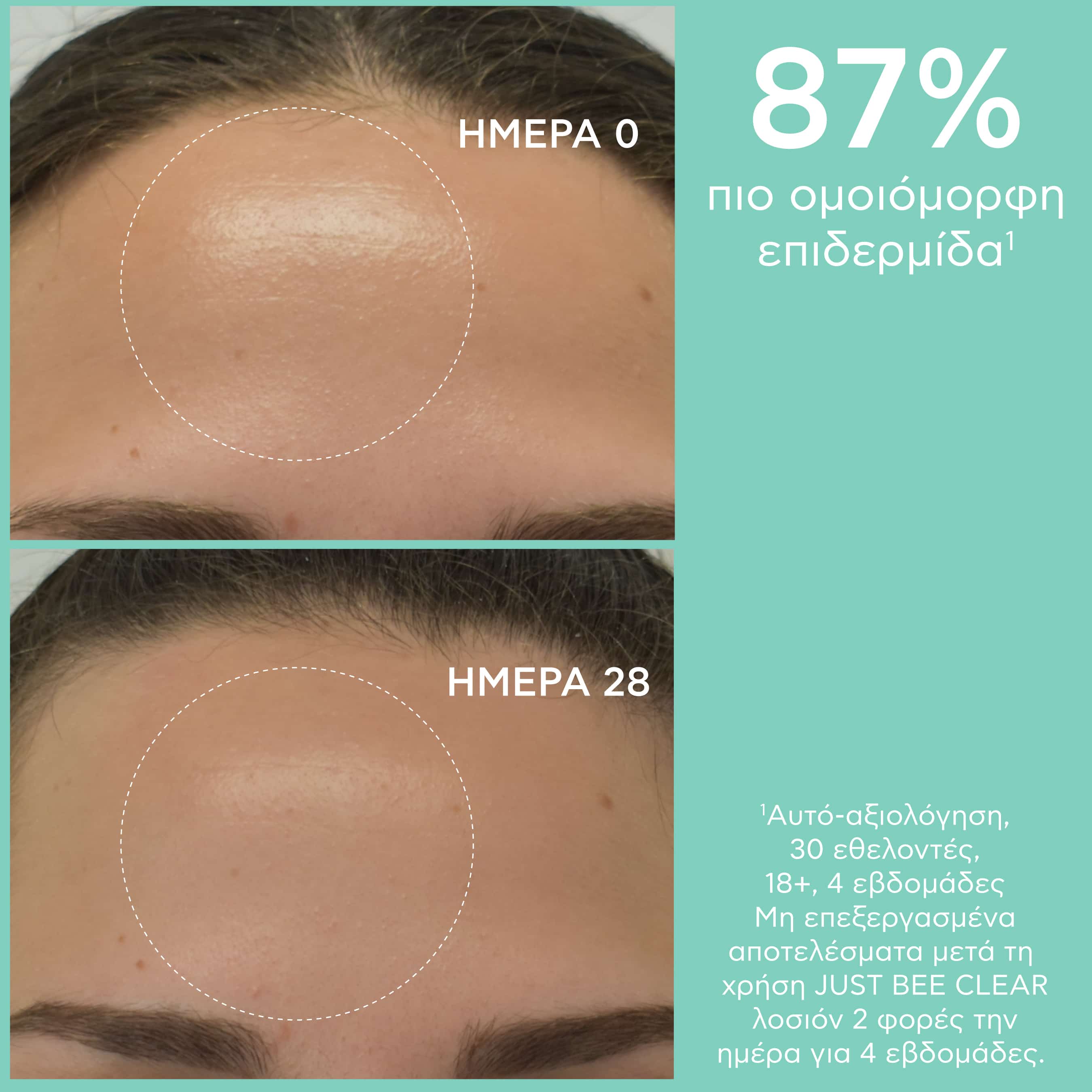 APIVITA - JUST BEE CLEAR Λοσιόν Σύσφιξη Πόρων με propolis AmC & φυτικό σαλικυλικό οξύ - 200ml