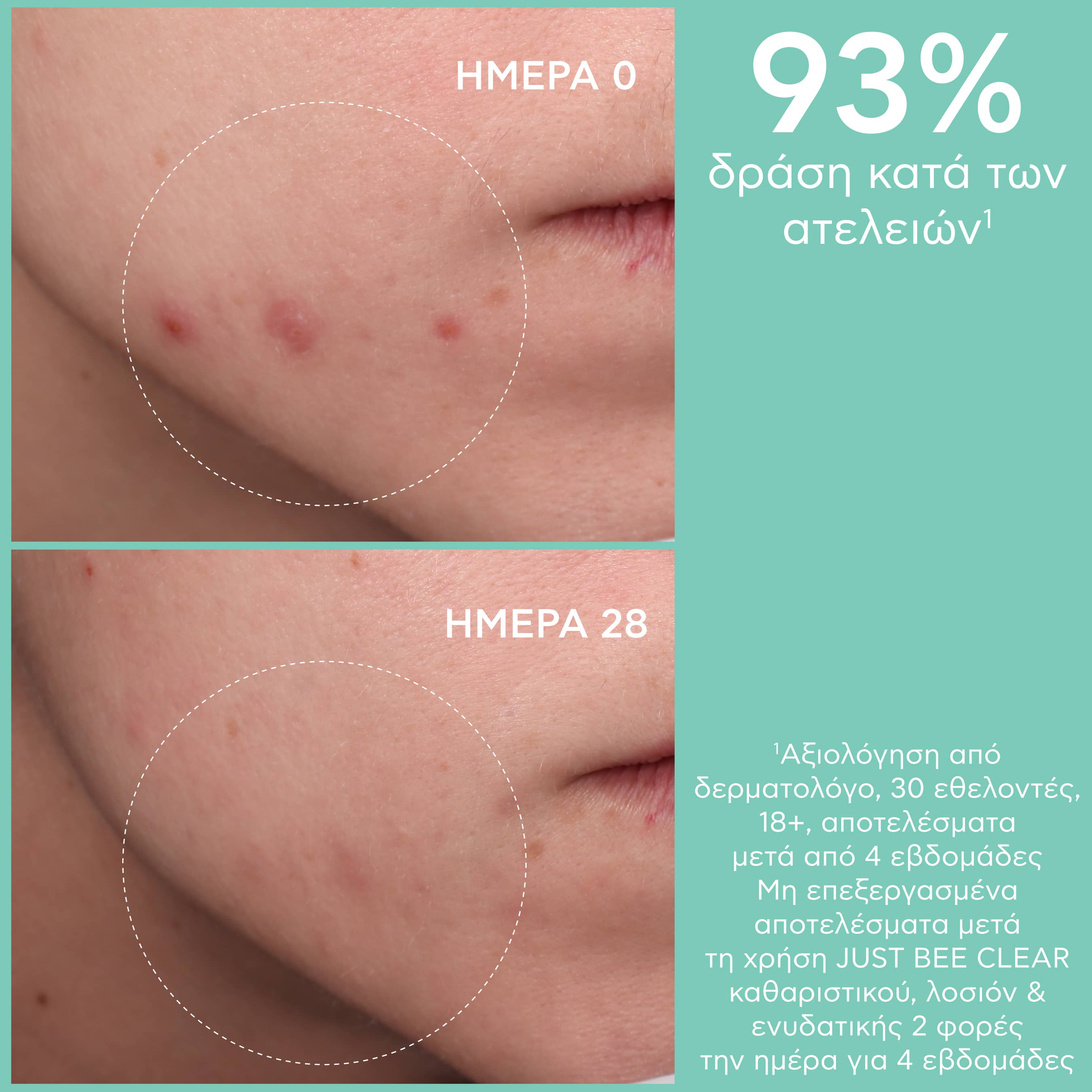 APIVITA - JUST BEE CLEAR Λοσιόν Σύσφιξη Πόρων με propolis AmC & φυτικό σαλικυλικό οξύ - 200ml